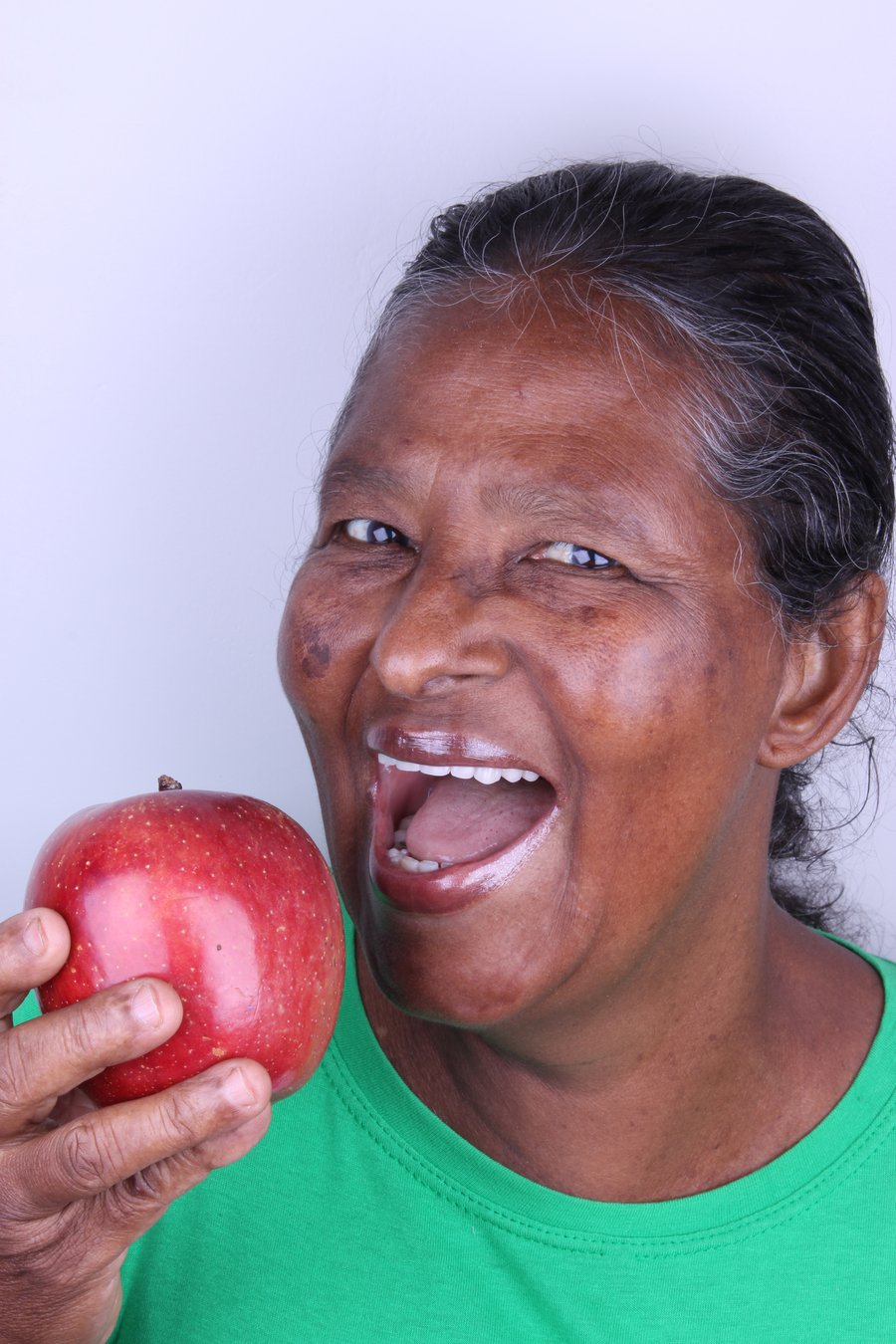 Paciente da Templare comendo com firmeza após Prótese Protocolo